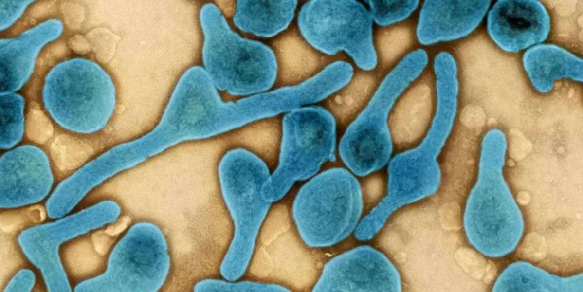 Virus de Marburgo: qué es, cómo se trasmite y cómo prevenir esta enfermedad infecciosa