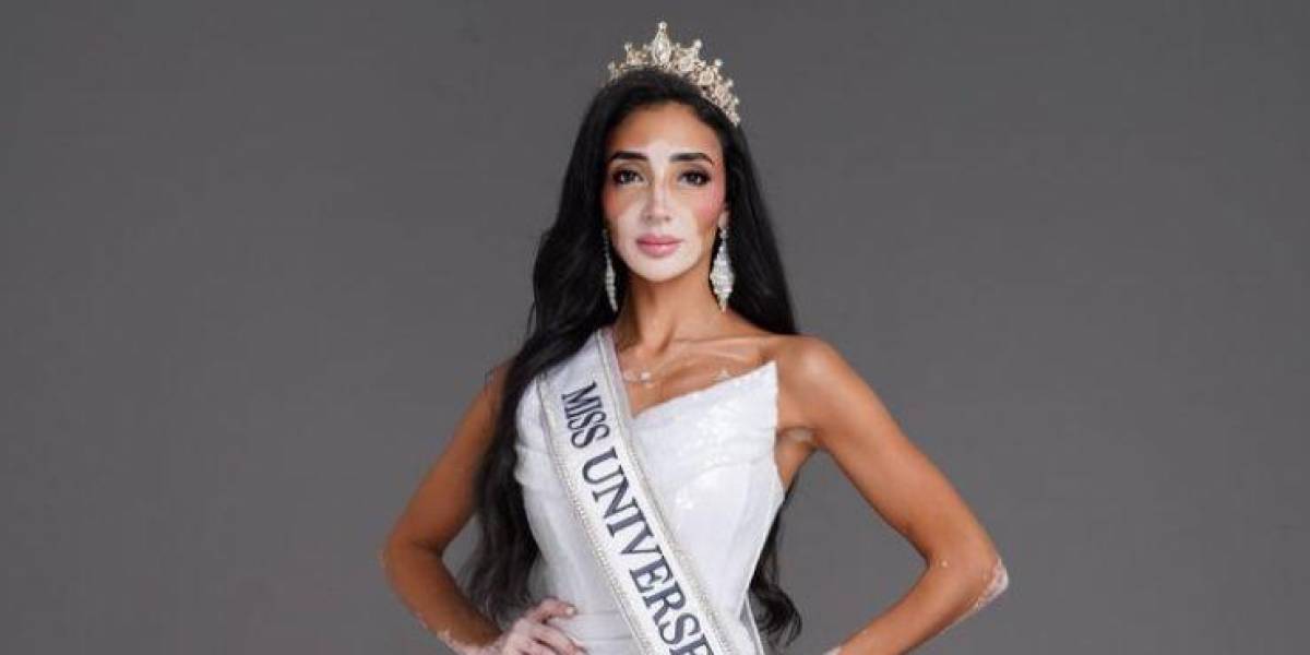 ¿Quién es Logina Salah? La primera aspirante a Miss Universo con vitiligo