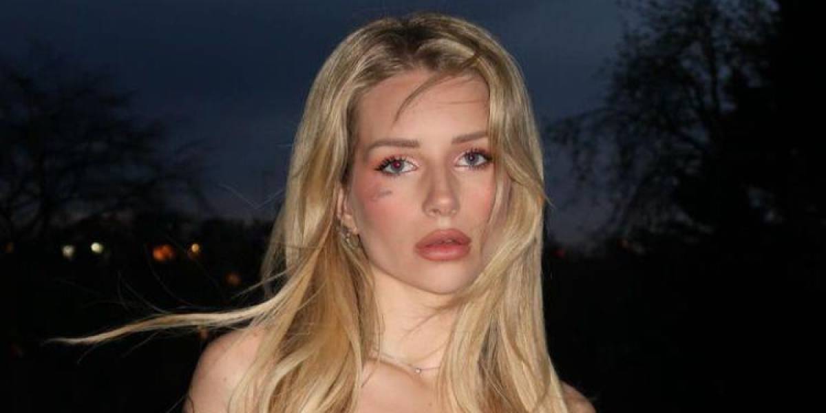 Lottie Moss revela su aterradora experiencia con Ozempic: Preferiría morir antes de volver a tomarlo