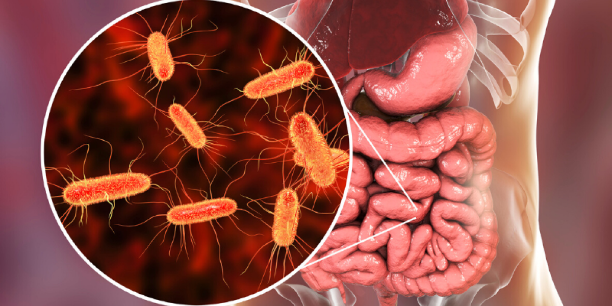 ¿Qué es la bacteria E.Coli? la cual generó un brote en una famosa cadena de comida rápida en EE.UU.