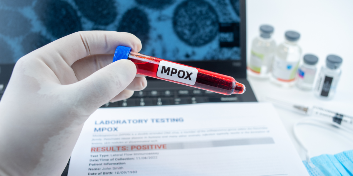 La OMS analiza probables nuevos casos en Europa de mpox