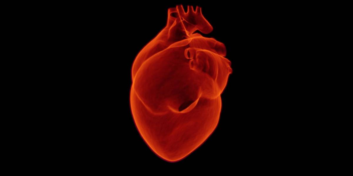 La deficiencia de hierro se asocia con infartos más grandes