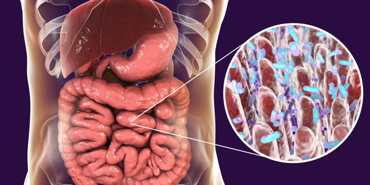 Este es el aditivo alimentario que podría causar cáncer intestinal