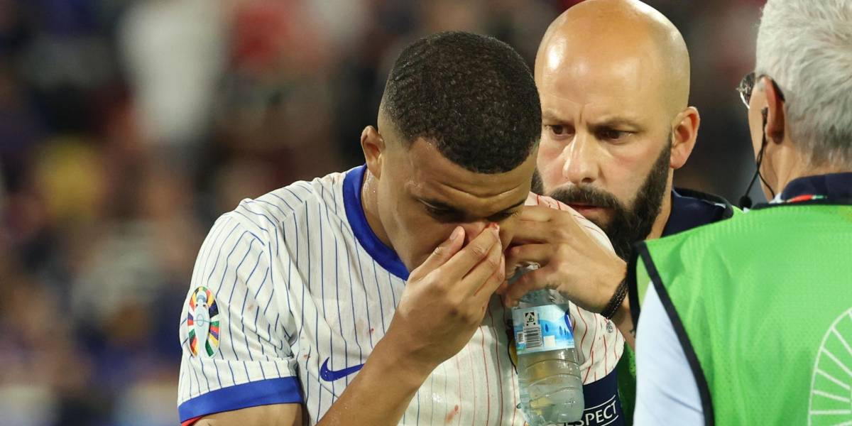 Kylian Mbappé sufrió una fractura de nariz y será operado en las próximas horas