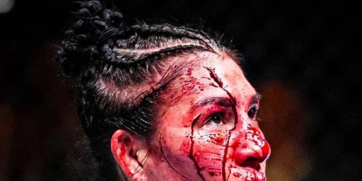 UFC: así quedó el rostro de Irene Aldana luego de sufrir distintas heridas en su derrota contra Norma Dumont