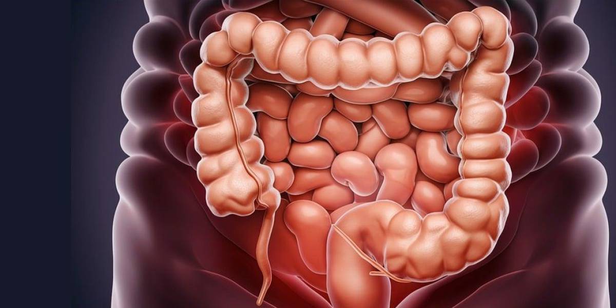 Estos síntomas del cáncer de colon pueden salvar tu vida si los detectas a tiempo