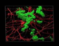 Reconstrucción en 3D de la deposición de placas de beta amiloide (verde) entre neuronas (rojo) cultivadas en el laboratorio.