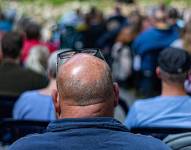 Imagen referencial, caída del cabello en hombres.