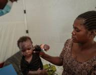 Un niño es ayudado por su madre mientras un trabajador de salud observa en el Mpox