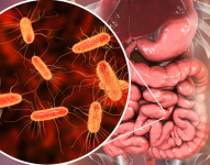 Imagen referencial de la bacteria Escherichia Coli en el intestino humano.