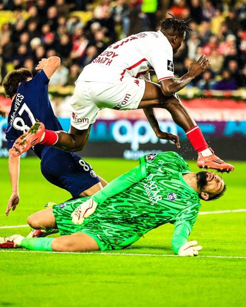 Así le quedó el rostro de Gianluigi Donnarumma, tras sufrir un duro golpe en la Liga Francesa