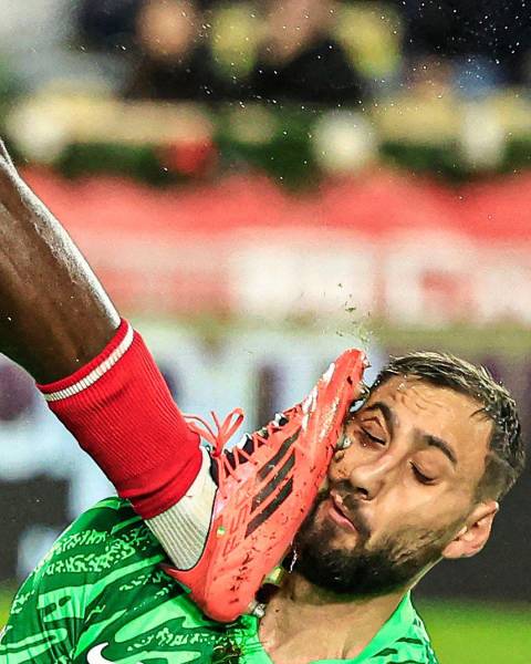 Así le quedó el rostro de Gianluigi Donnarumma, tras sufrir un duro golpe en la Liga Francesa