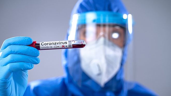 Detectan más centros sin permisos para hacer pruebas COVID-19