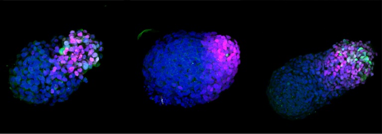 Desarrollan un modelo de embrión humano a partir de células madre