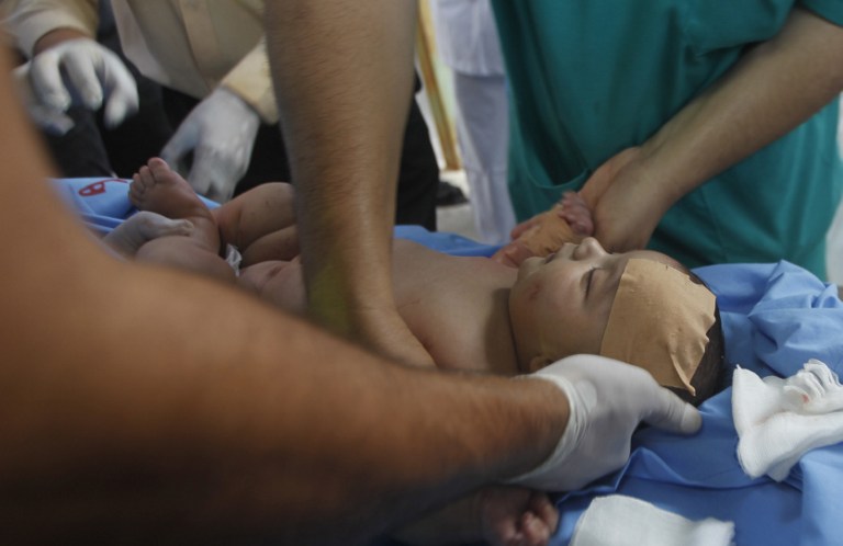 Los hospitales de Gaza desbordados por los horrores de la guerra