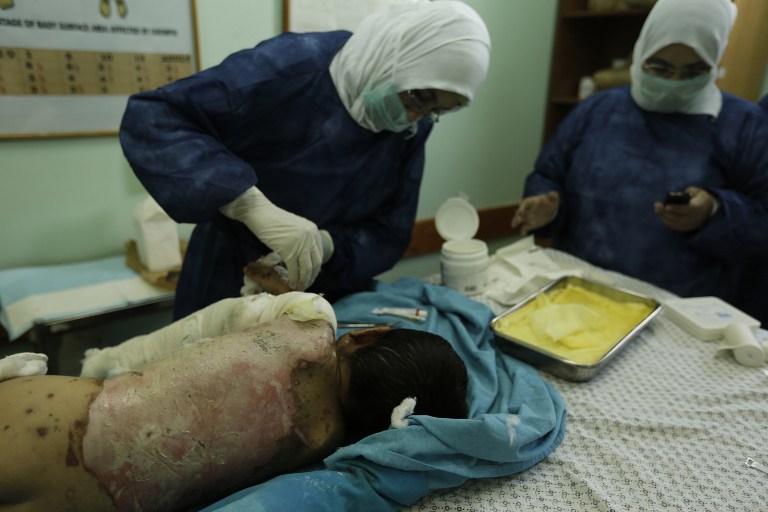 Los hospitales de Gaza desbordados por los horrores de la guerra