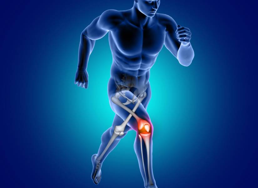 Imagen referencial: Articulaciones de la rodilla en rojo.