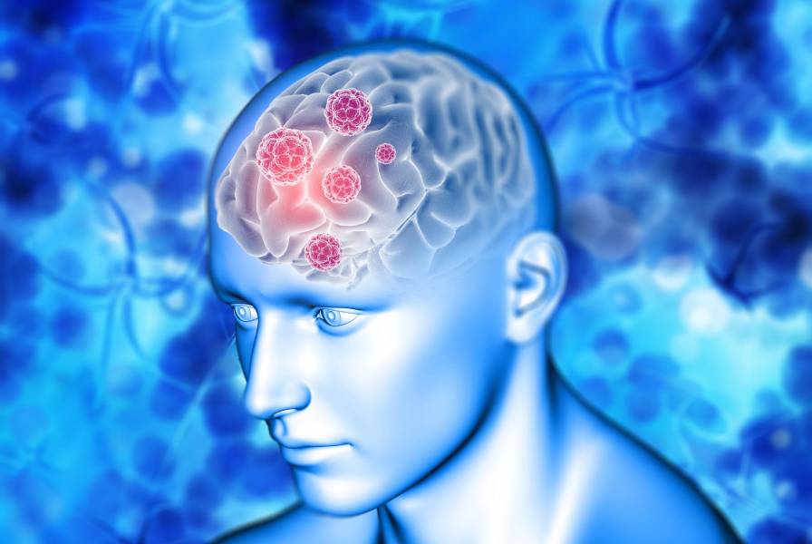 Accidente cerebrovascular: reconoce los síntomas a tiempo