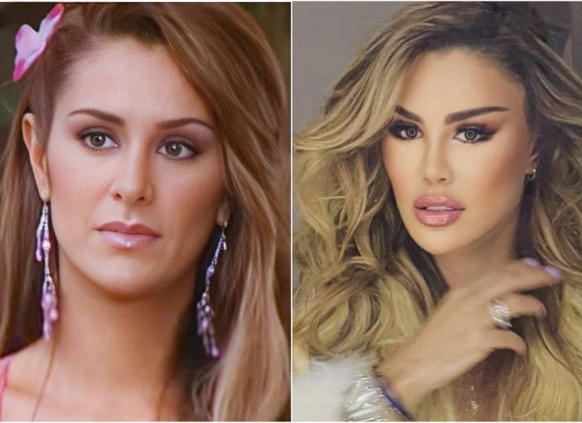 Antes y después de Ninel Conde.